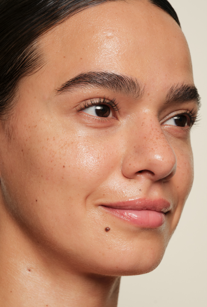 After 1 Use using Moisture Rich Balm